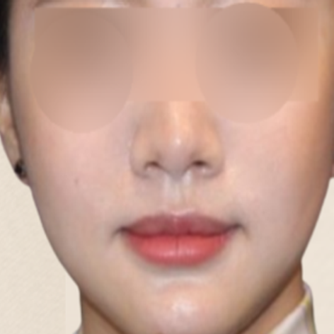 Before Image