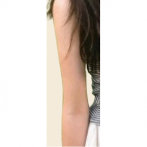 팔 카티 지방분해주사