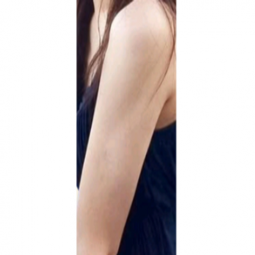 팔 카티 지방분해주사