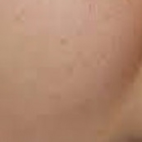 기능의학 수액 프로그램 (글루타치온 백옥주사)